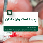 پیوند استخوان دندان