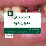 کاشت دندان بدون درد