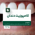 کامپوزیت دندان