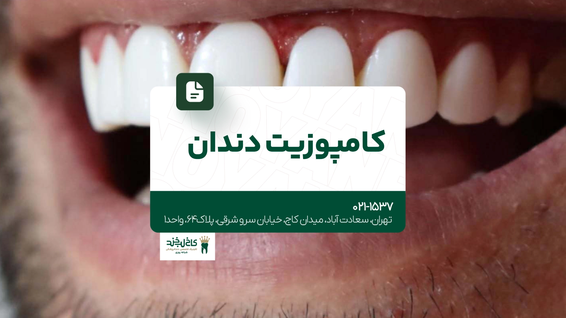 کامپوزیت دندان