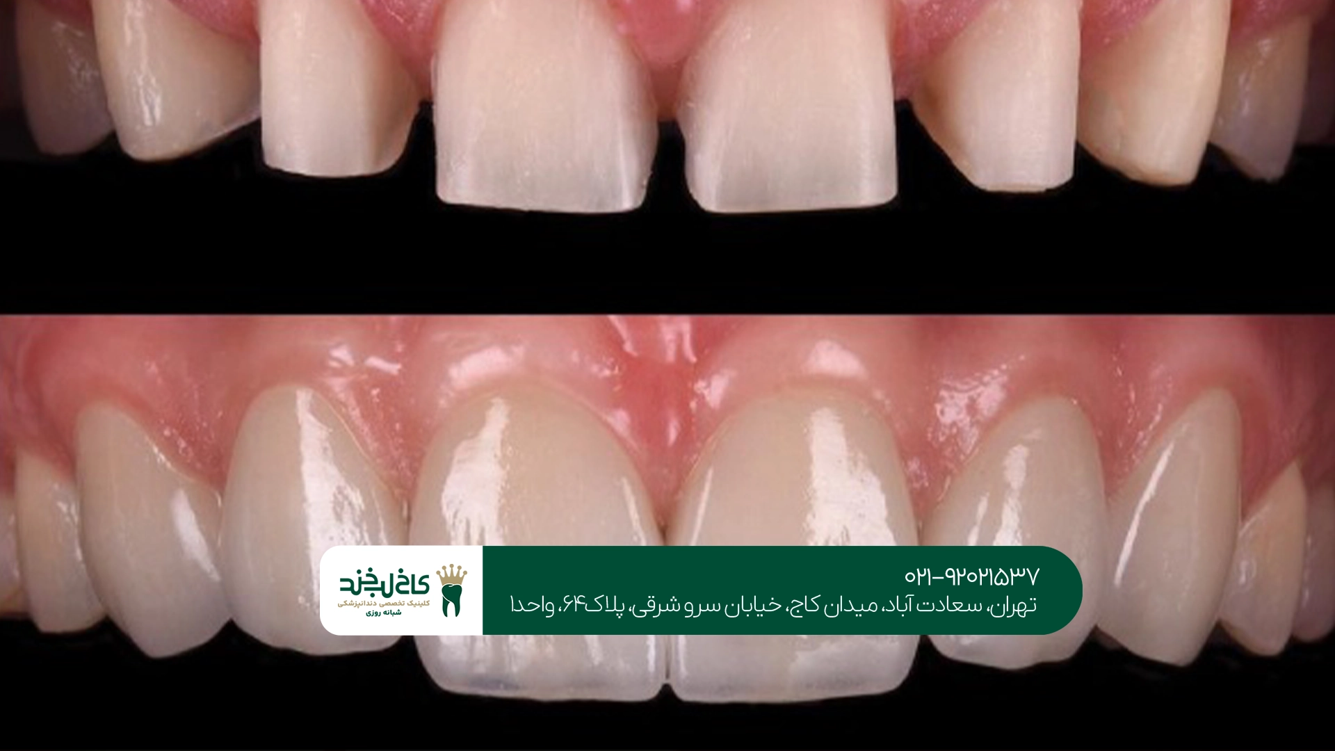 بهترین مرکز کامپوزیت دیجیتال