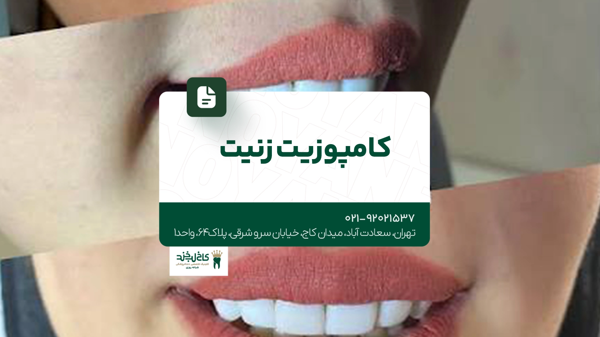کامپوزیت زنیت