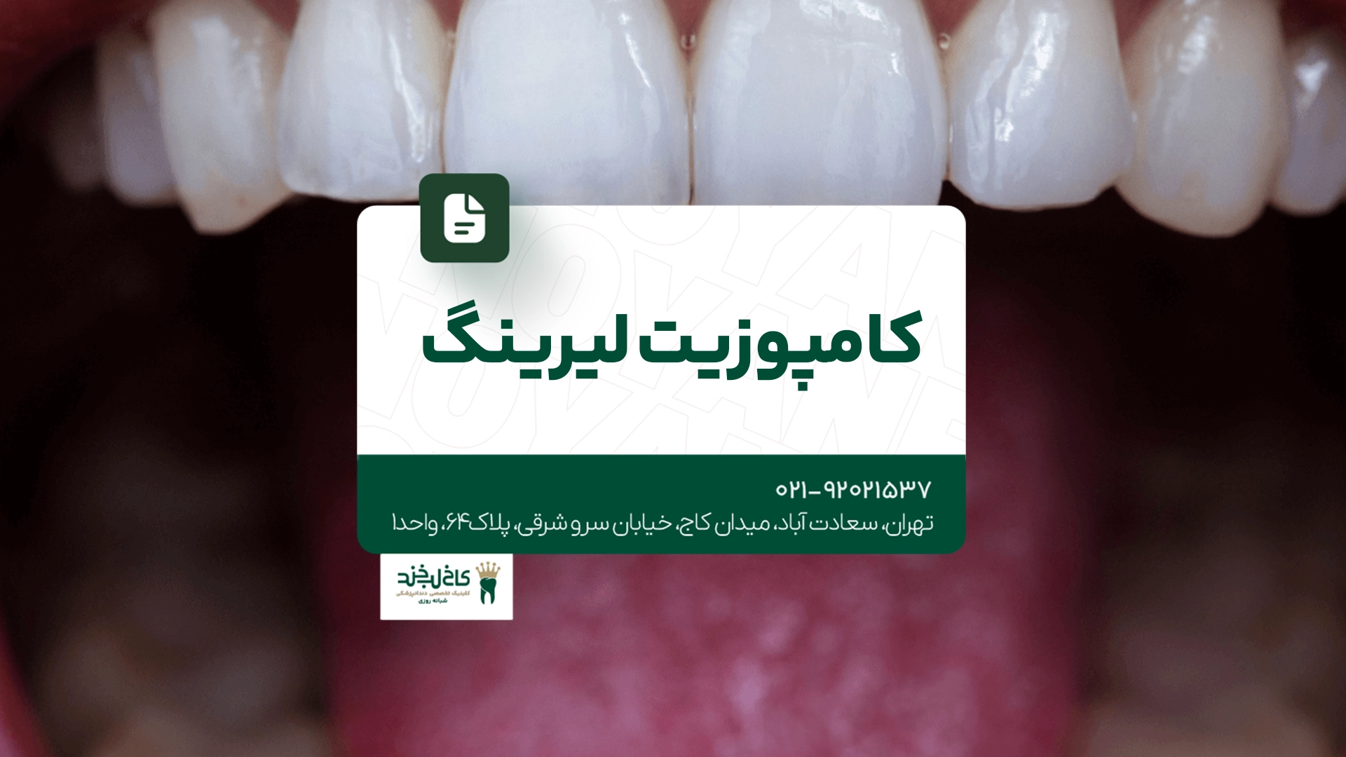 کامپوزیت لیرینگ