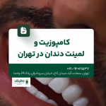 کامپوزیت و لمینت دندان در تهران