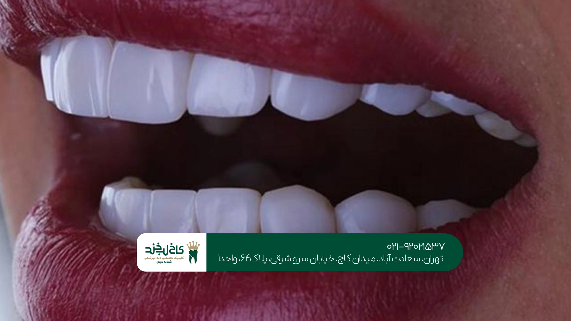 دندانپزشکی زیبایی دندانپزشکی زیبایی