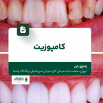 کامپوزیت