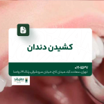 کشیدن دندان