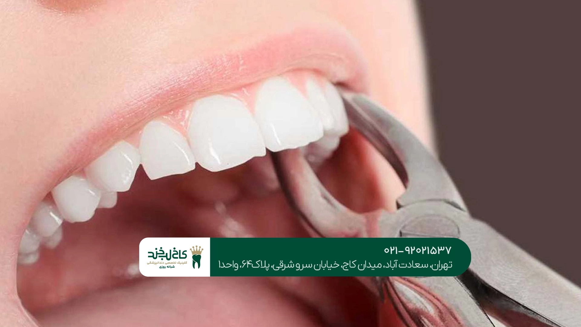 دکتر کشیدن دندان بدون درد