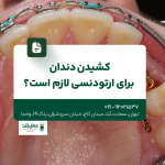 کشیدن دندان برای ارتودنسی لازم است؟