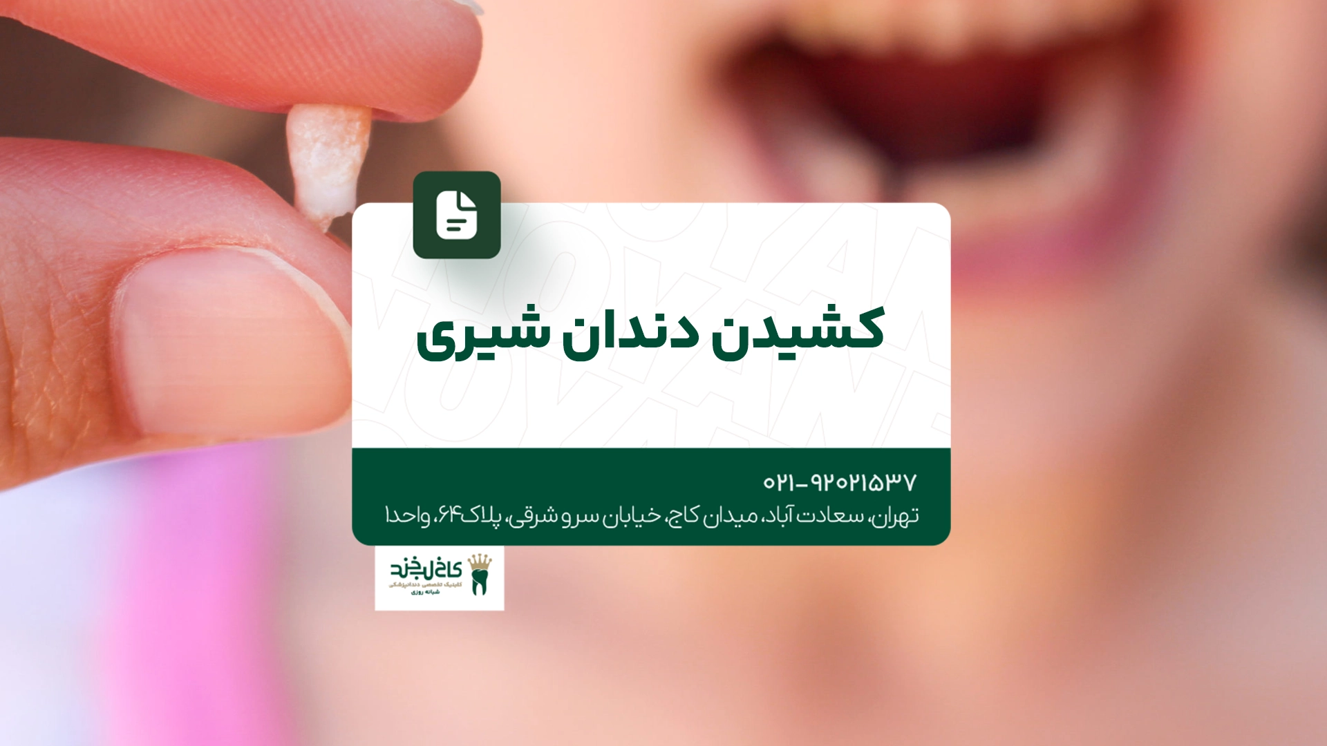 کشیدن دندان شیری کشیدن دندان شیری