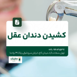 کشیدن دندان عقل