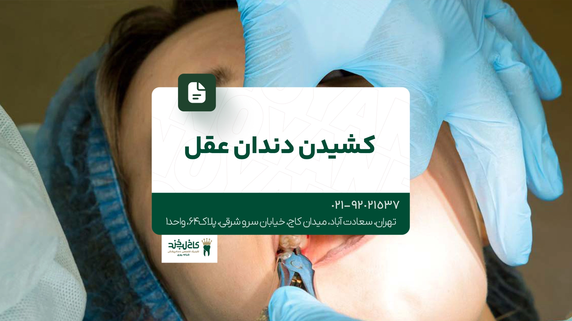 کشیدن دندان عقل کشیدن دندان عقل