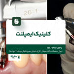 کلینیک ایمپلنت