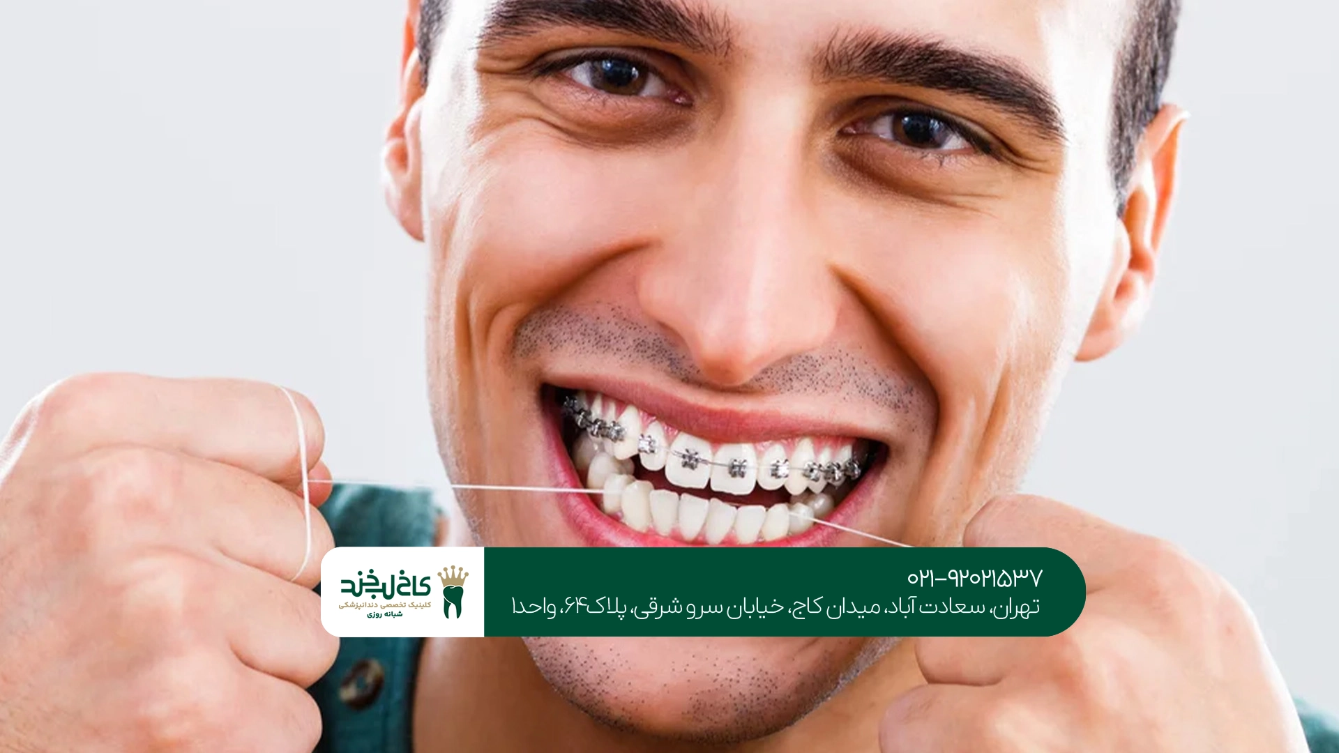 مزایای ارتودنسی بزرگسالان