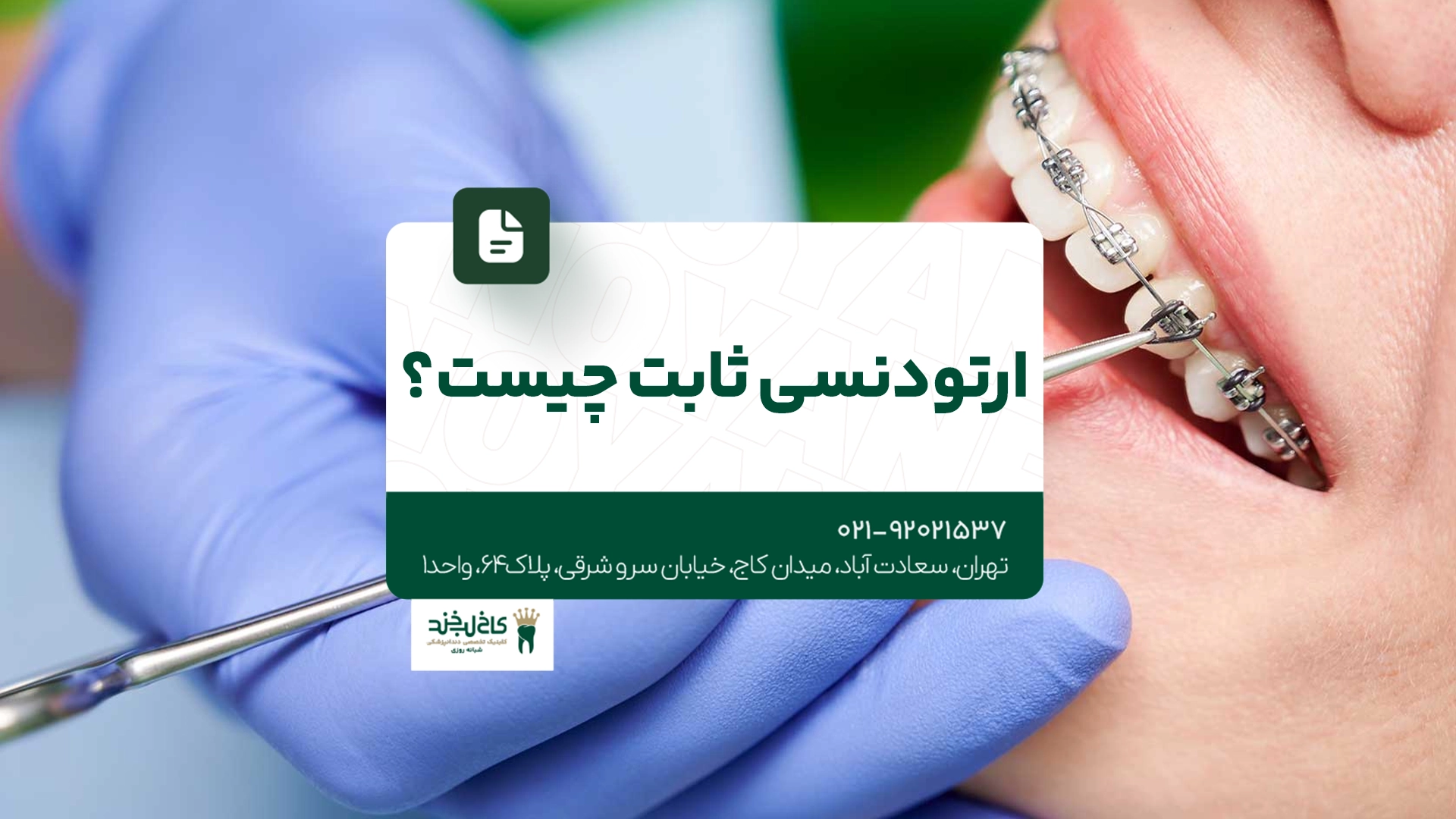 ارتودنسی ثابت چیست ارتودنسی ثابت چیست