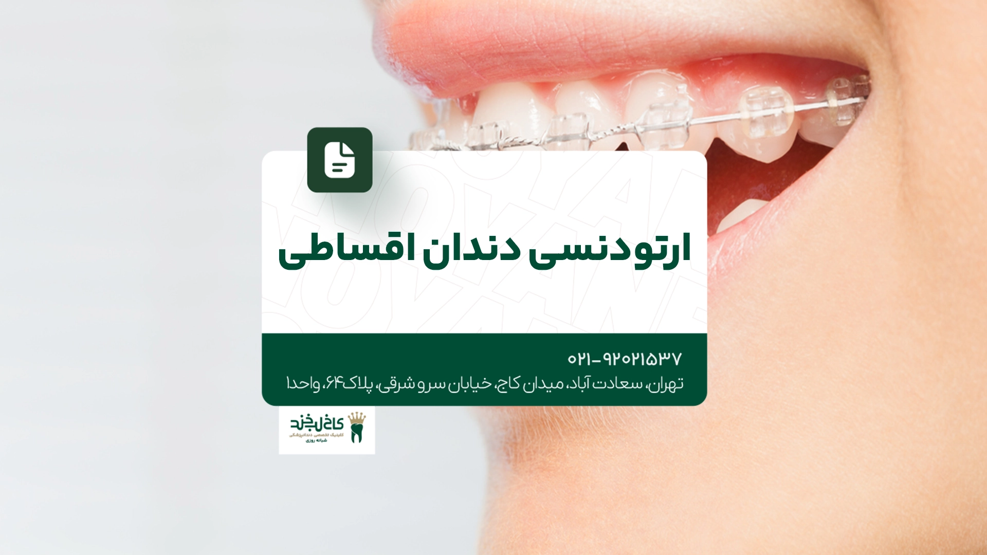 ارتودنسی دندان اقساطی