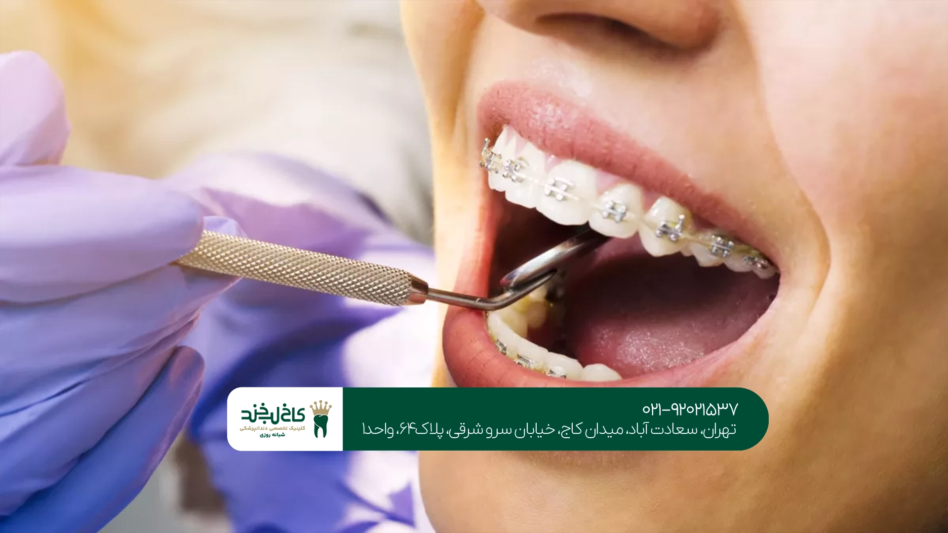 ارتودنسی اقساطی دندان