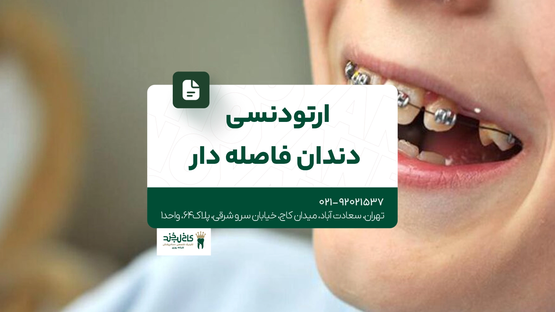 ارتودنسی دندان فاصله دار ارتودنسی دندان فاصله دار