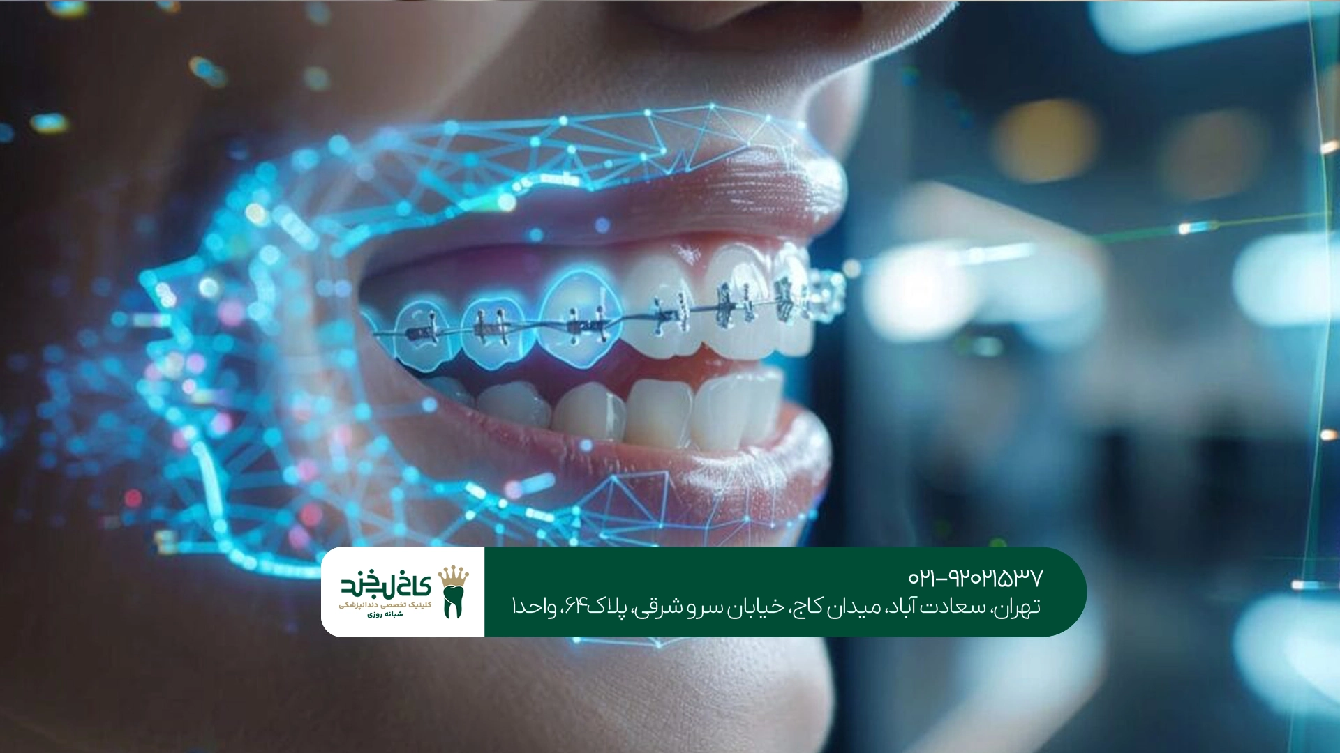 بهترین مرکز ارتودنسی دیجیتال تهران بهترین مرکز ارتودنسی دیجیتال تهران