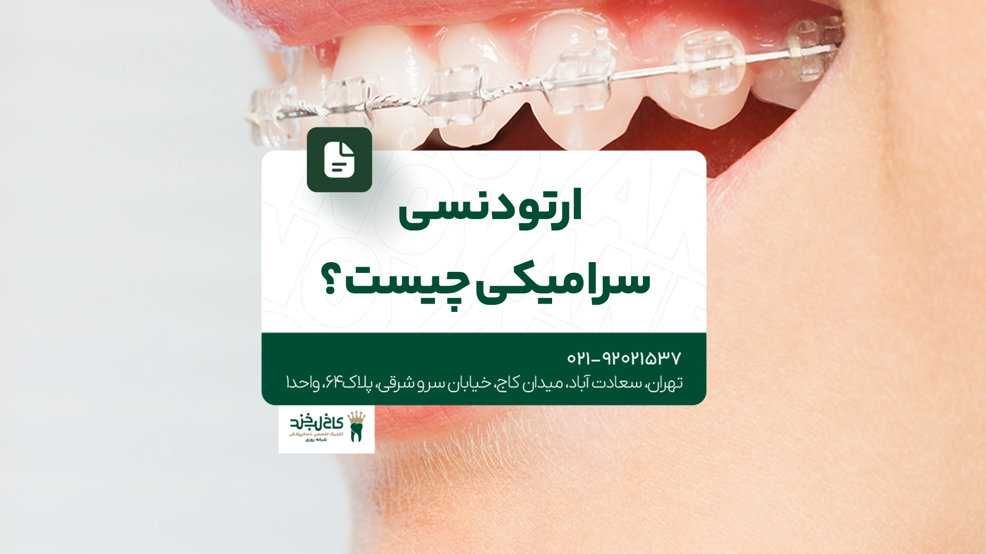 ارتودنسی سرامیکی چیست ارتودنسی سرامیکی چیست