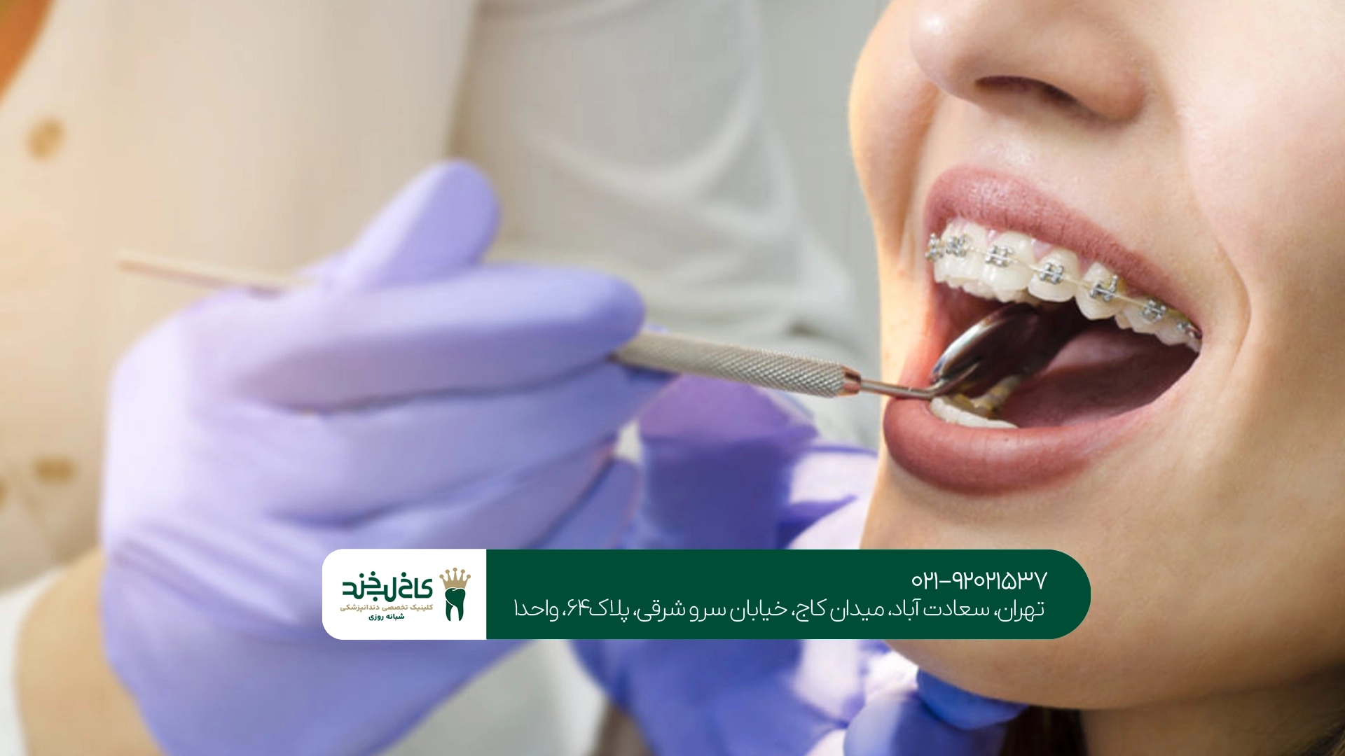 بهترین متخصص ارتودنسی فک بالا
