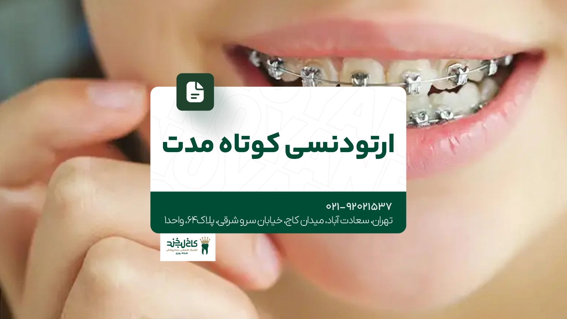 ارتودنسی کوتاه مدت