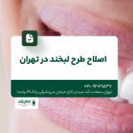 اصلاح طرح لبخند در تهران