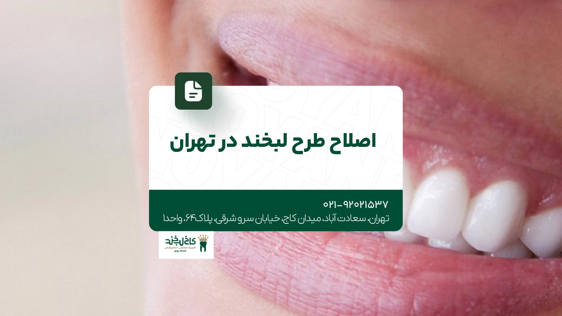اصلاح طرح لبخند در تهران اصلاح طرح لبخند در تهران