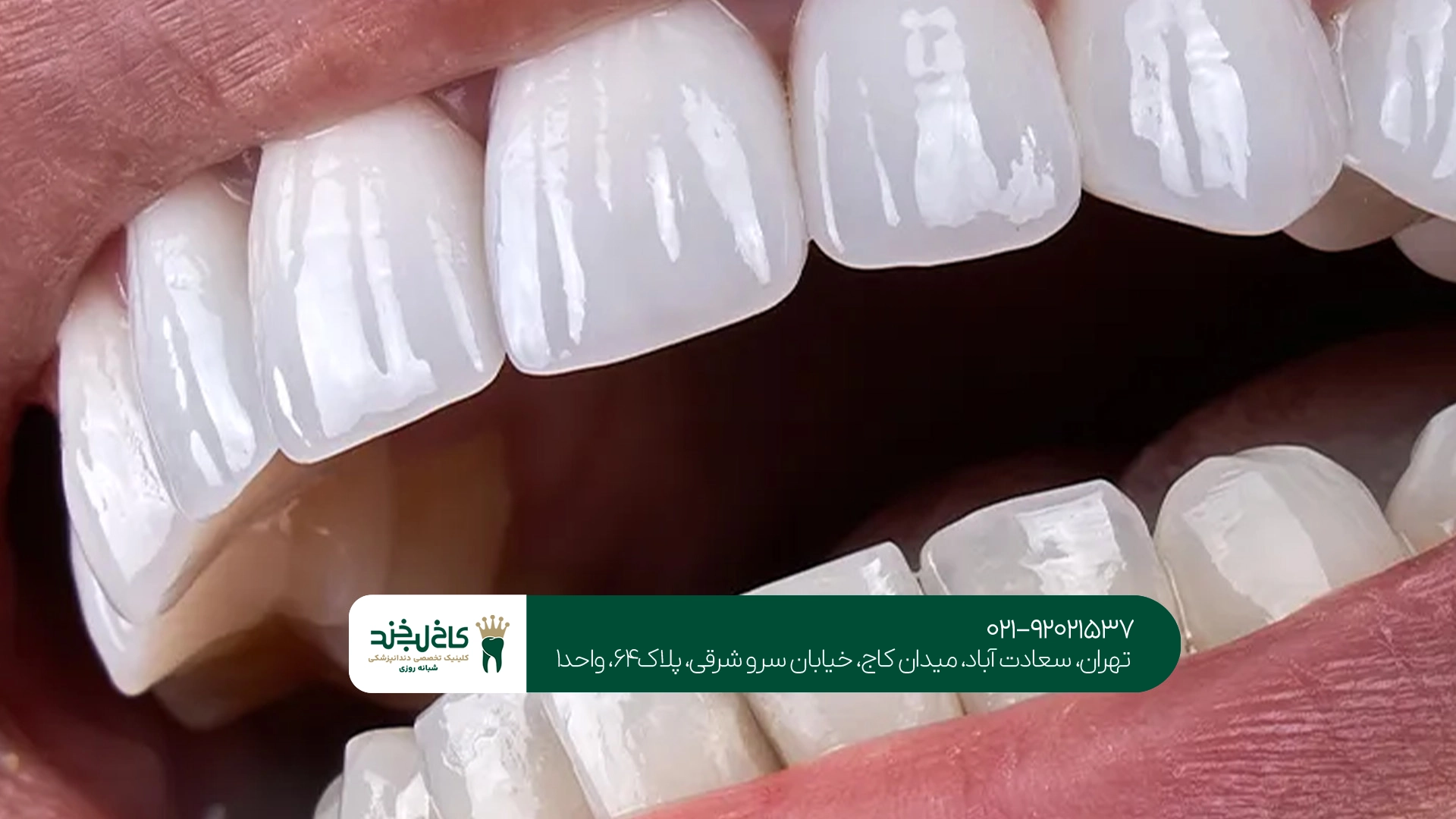بهترین کلینیک اصلاح طرح لبخند بهترین کلینیک اصلاح طرح لبخند