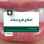 اصلاح طرح لبخند
