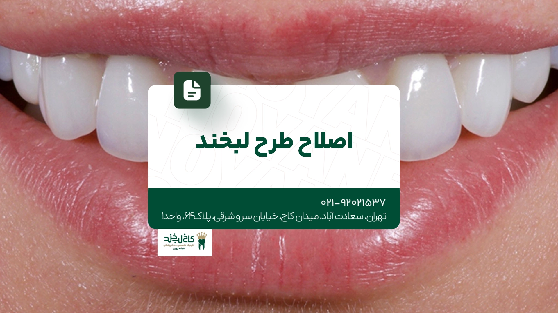 اصلاح طرح لبخند اصلاح طرح لبخند
