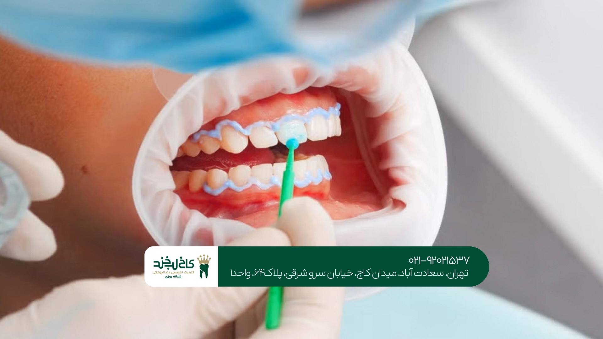 بهترین کلینیک دندانپزشکی بهترین کلینیک دندانپزشکی