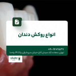 انواع روکش دندان