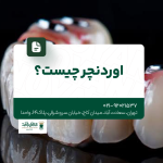 اوردنچر چیست؟