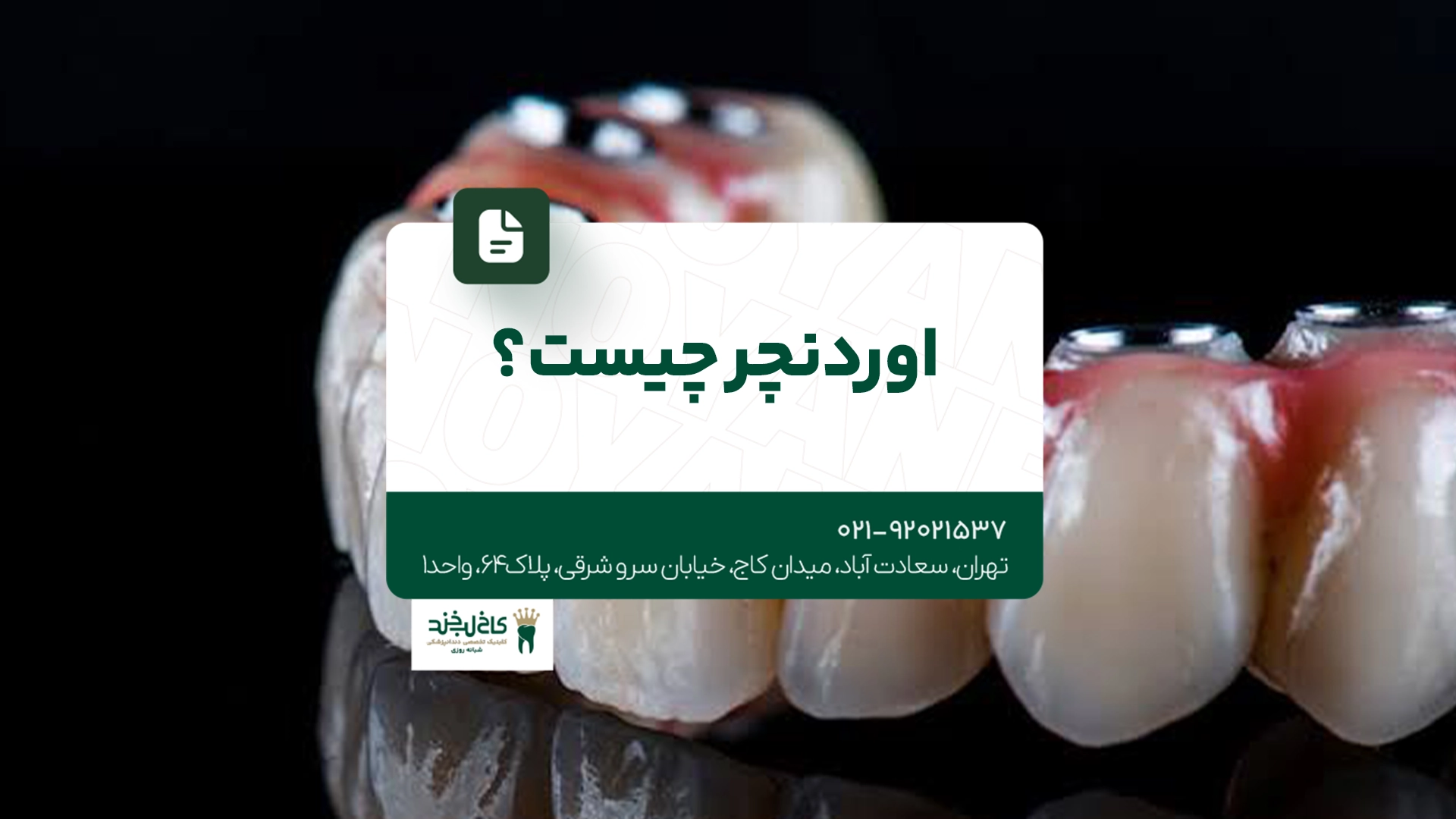 اوردنچر چیست؟ اوردنچر چیست؟