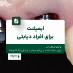ایمپلنت برای افراد دیابتی