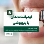 ایمپلنت دندان با بیهوشی