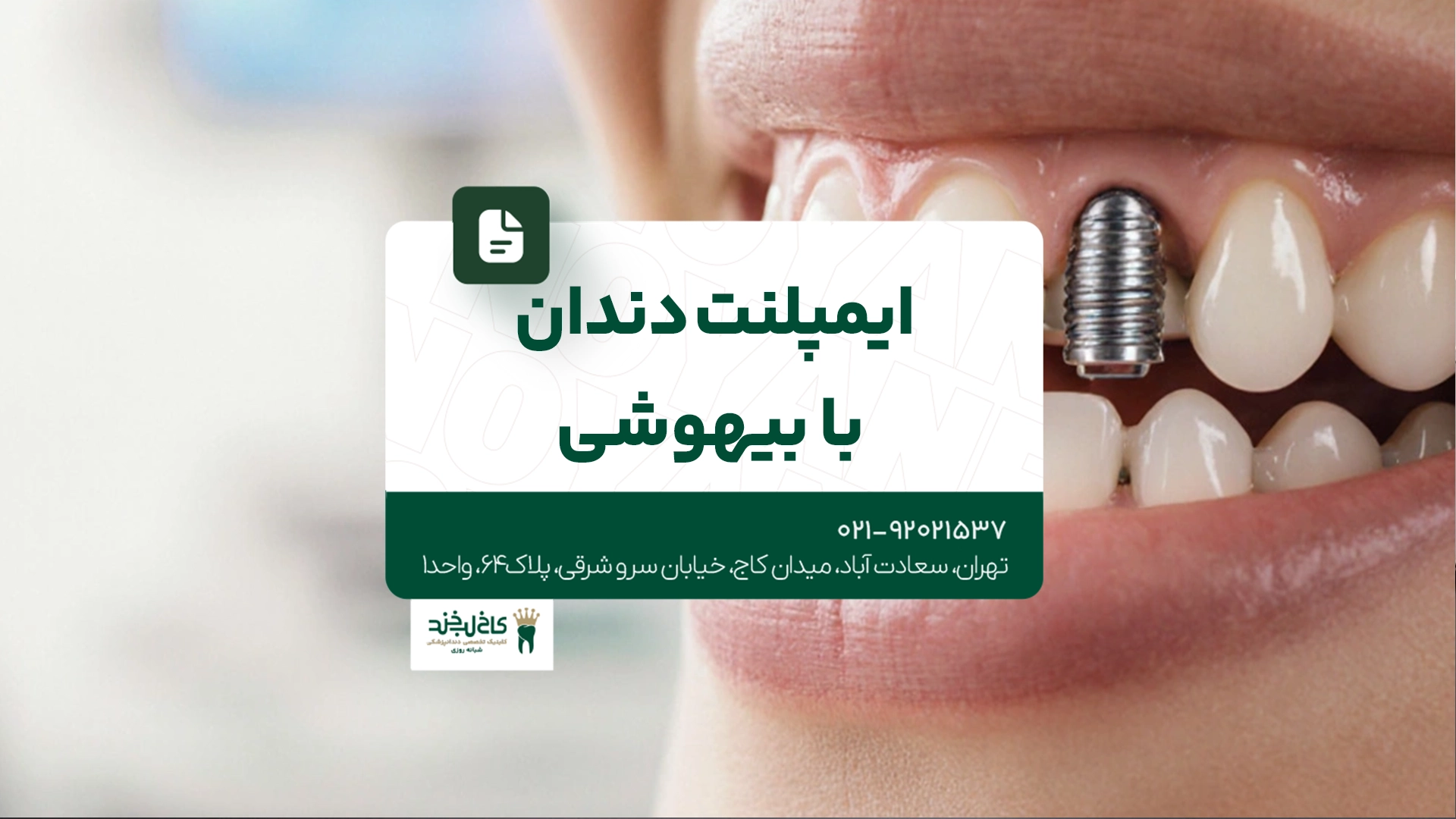 ایمپلنت دندان با بیهوشی