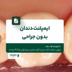 ایمپلنت دندان بدون جراحی