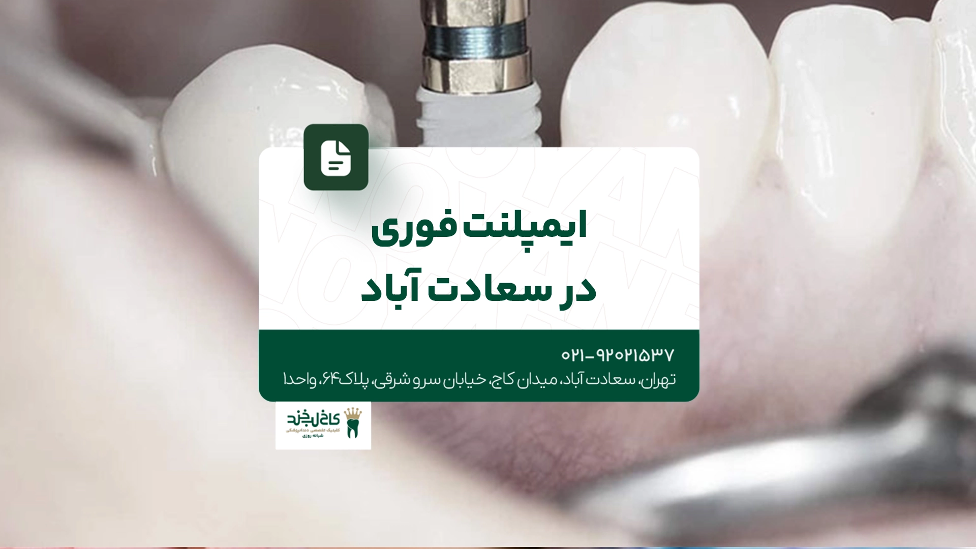 ایمپلنت فوری در سعادت آباد ایمپلنت فوری در سعادت آباد