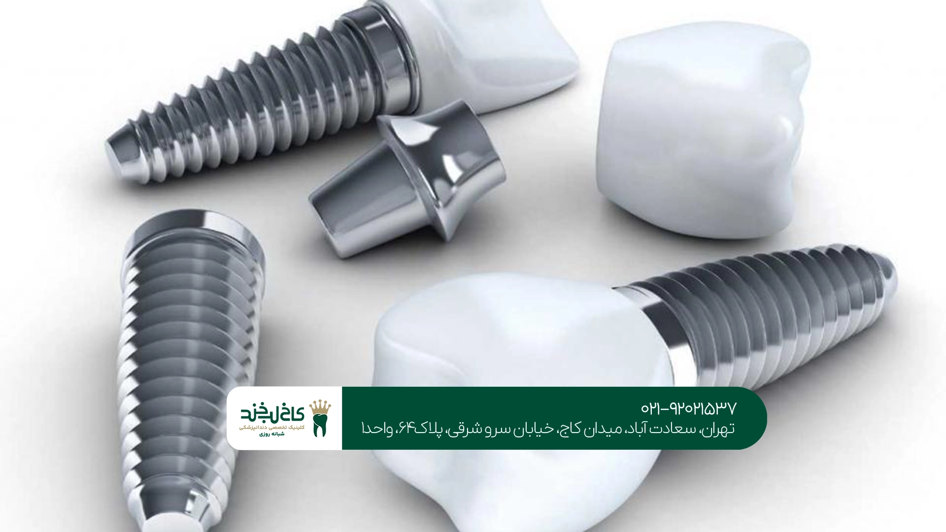 متخصص ایمپلنت کرهای در تهران