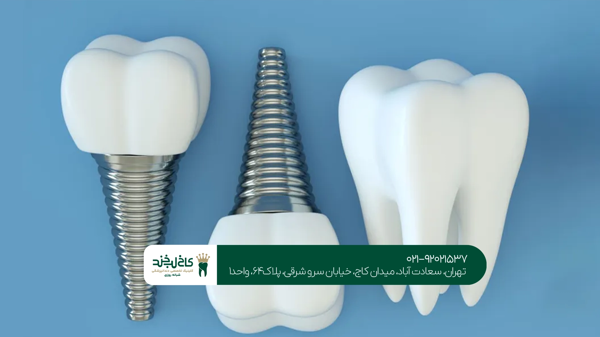 آیا ایمپلنت کرهای کیفیت و دوام بالایی دارد؟