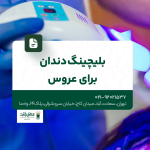 بلیچینگ دندان برای عروس