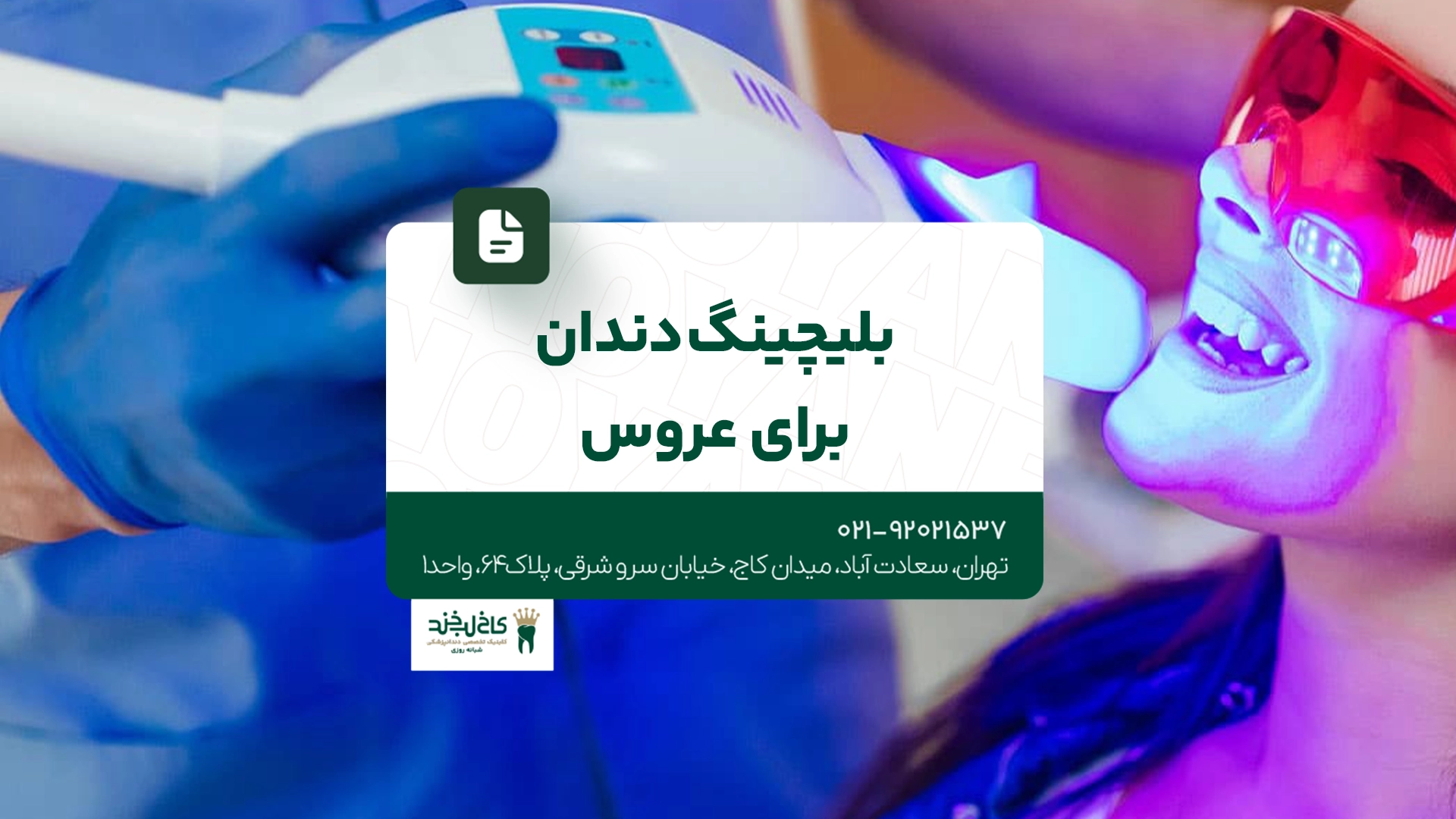 بلیچینگ دندان برای عروس