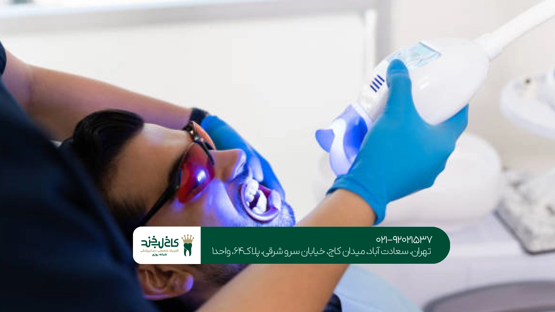 بلیچینگ دندان عروس تهران