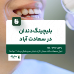 بلیچینگ دندان در سعادت آباد