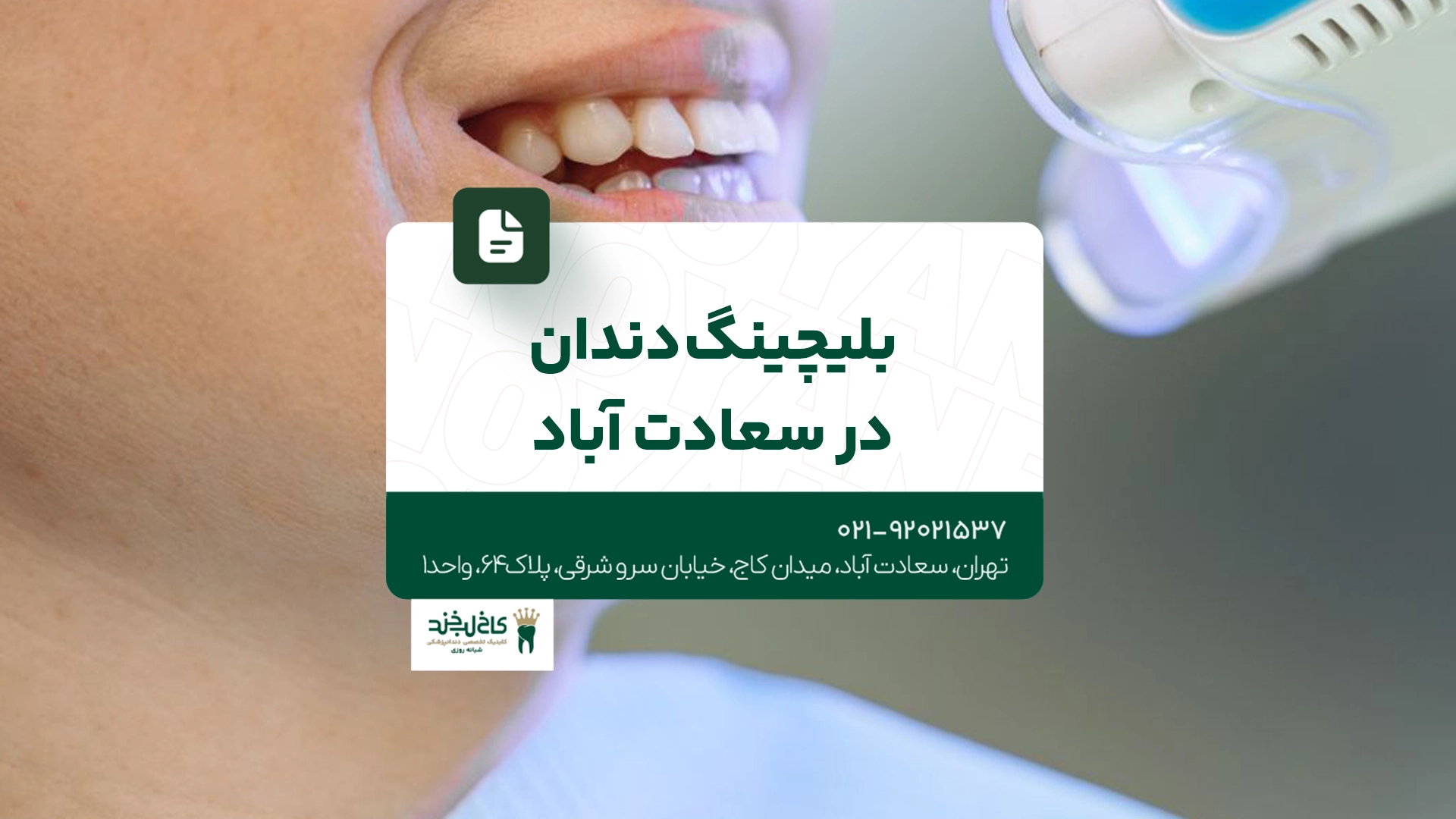 بلیچینگ دندان در سعادت آباد بلیچینگ دندان در سعادت آباد