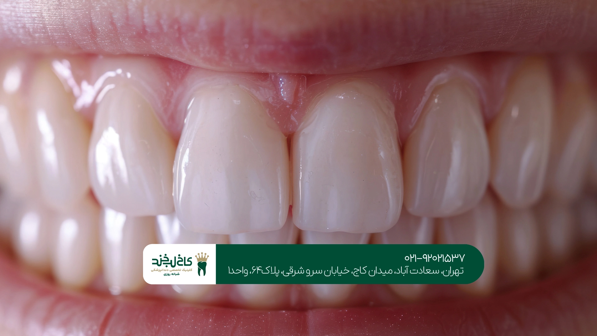 دندانپزشکی زیبایی دندانپزشکی زیبایی
