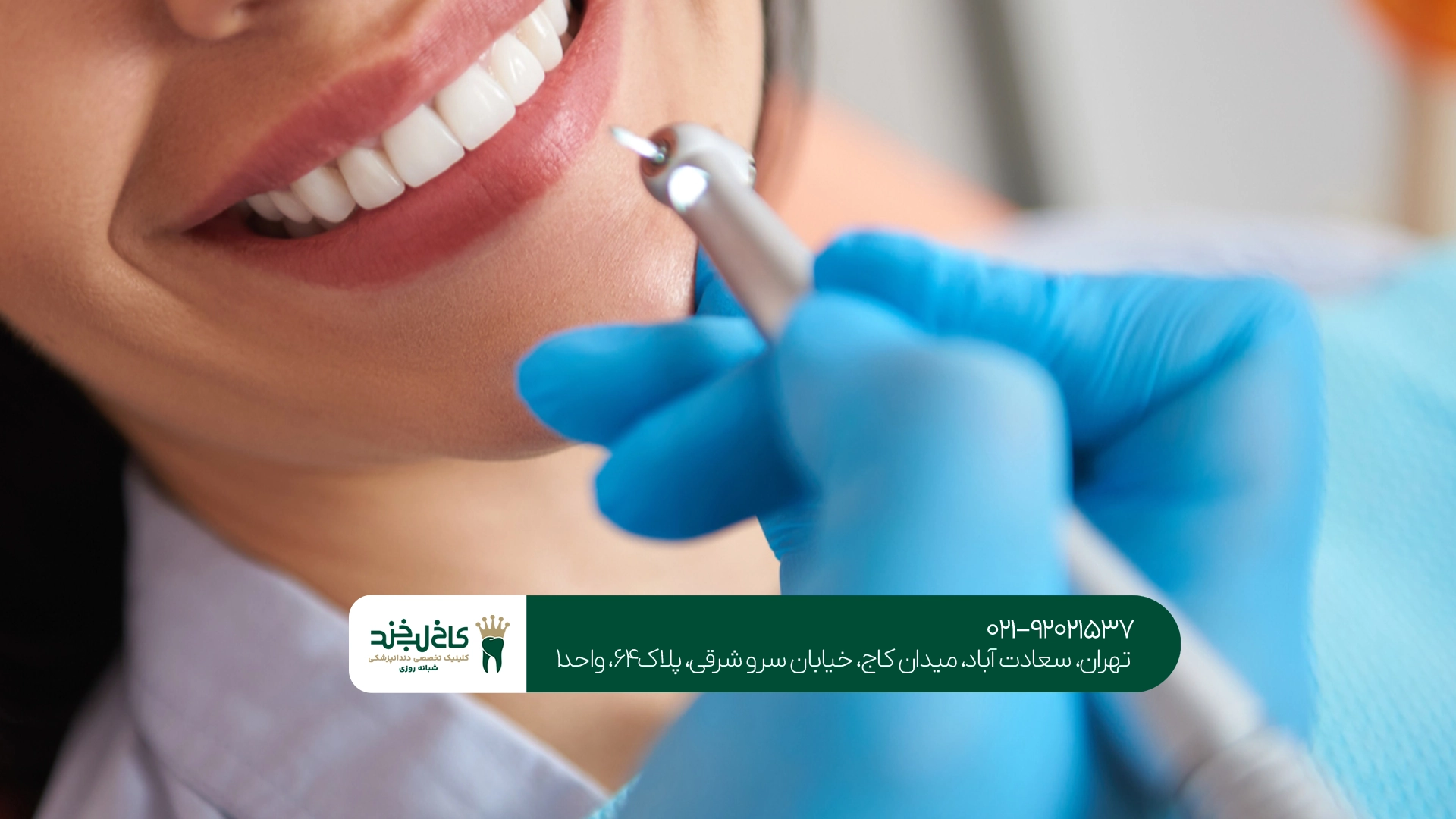 کامپوزیت و لمینت دندان در تهران کامپوزیت و لمینت دندان در تهران