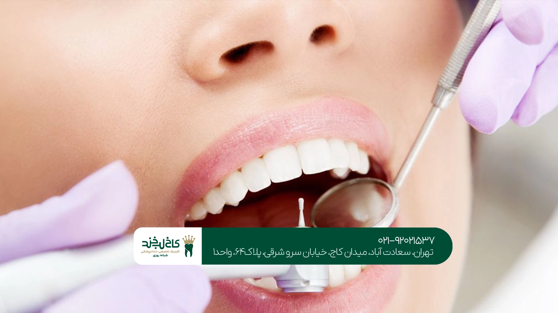 دندانپزشکی زیبایی تهران دندانپزشکی زیبایی تهران